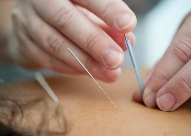 How Chinese Medical Treatments Can Benefit Your Overall Health?