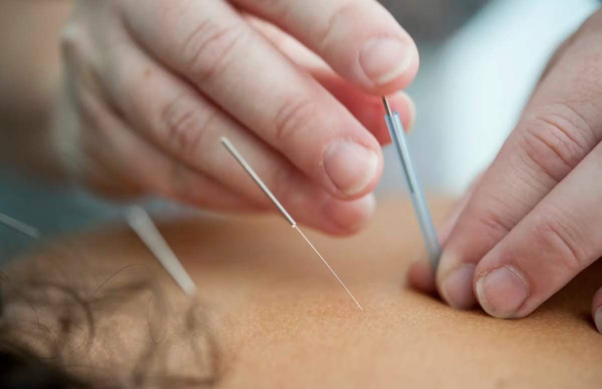 How Chinese Medical Treatments Can Benefit Your Overall Health?