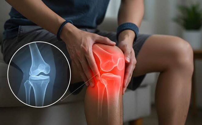 This is the Knee Replacement Recovery Timeline and What You Can Expect from Your Surgery