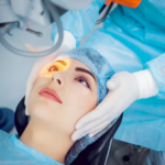 LASIK Surgery
